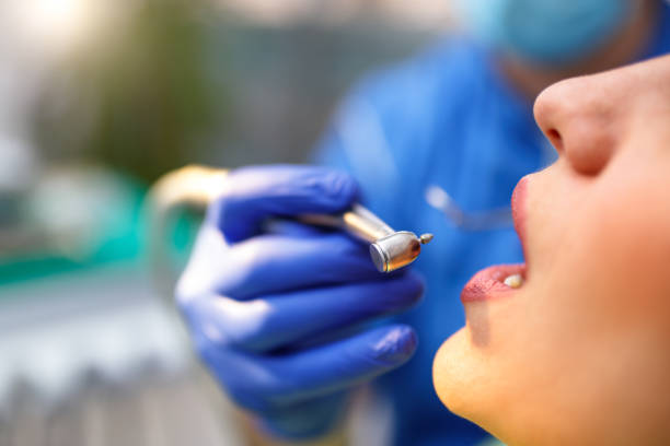 Best Wisdom Tooth Removal  in Los Gatos, CA
